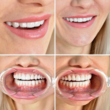 Slider image (4) Astra Dental Clinic